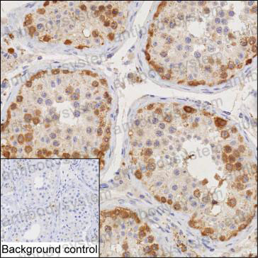 Anti-CTAG1A/NY-ESO-1/LAGE-2 Antibody (R3P69)