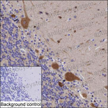 Anti-SRPK2 Antibody (R3P70)
