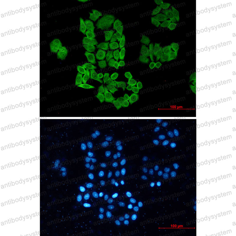 Anti-CCT2 Antibody (R2B28)