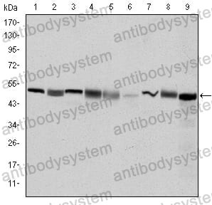 Anti-CCT2 Antibody (R3P72)