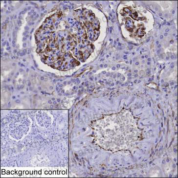Anti-OLR1/LOX1 Antibody (R3P74)