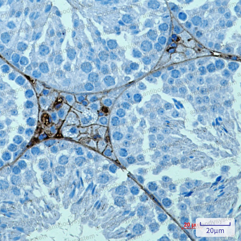 Anti-PRAME Antibody (R2B29)