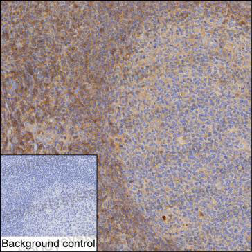 Anti-BTN3A2 Antibody (R3P75)