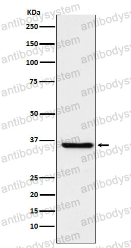 Anti-GSTO1 Antibody (R2B30)