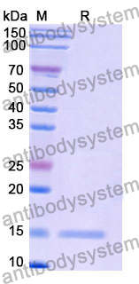 Anti-Human CD339/JAG1 Nanobody (SAA1285)