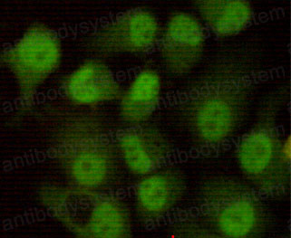 Anti-PRKDC Antibody (R3P81)