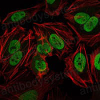 Anti-PRKDC Antibody (R3P79)