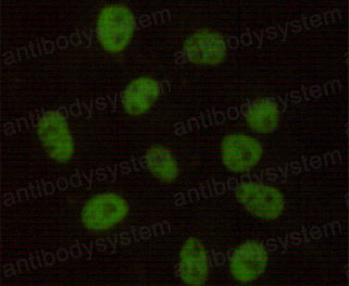 Anti-PRKDC Antibody (R3P80)