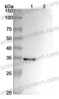 Anti-Human CD156b/ADAM17 Antibody (SAA2069)