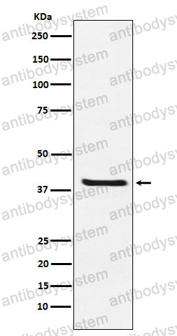 Anti-ARG2/Arginase II Antibody (R2B33)