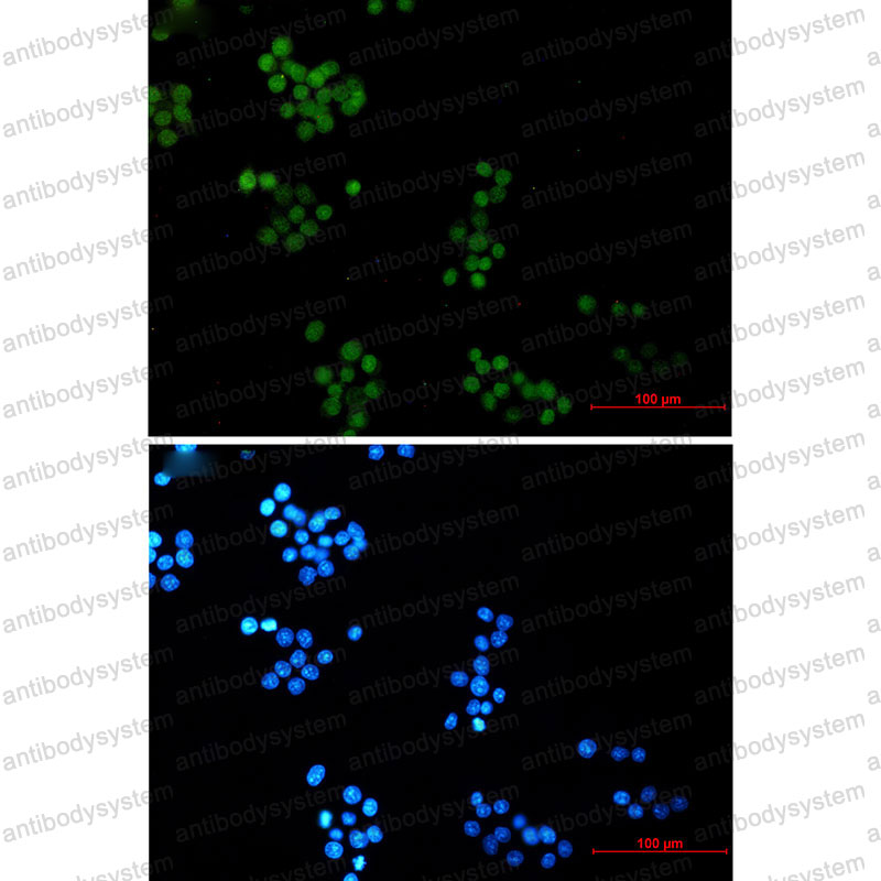 Anti-NTHL1 Antibody (R2B36)