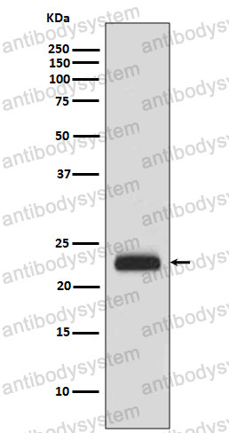 Anti-CRADD Antibody (R1B19)