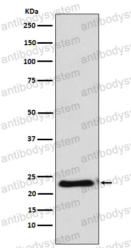 Anti-CRADD Antibody (R2B37)