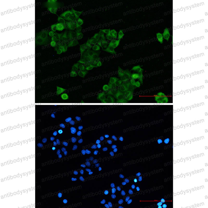 Anti-CRADD Antibody (R2B38)