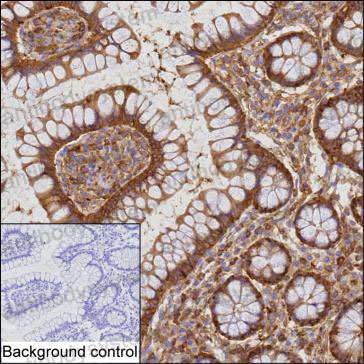 Anti-CCL8/MCP-2 Antibody (R3P85)