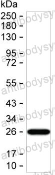Anti-CCL8/MCP-2 Antibody (R3P84)