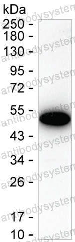 Anti-CXCL6/GCP-2 Antibody (R3P87)