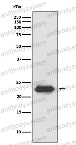 Anti-LCN2/NGAL Antibody (R2B39)