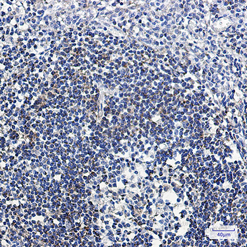 Anti-ABAT Antibody (R2B42)