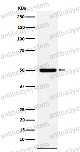 Anti-ABAT Antibody (R2B40)