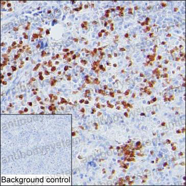 Anti-S100A12 Antibody (R3P90)