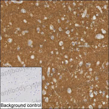 Anti-BASP1 Antibody (R3P91)