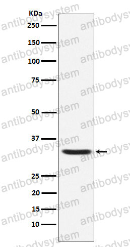 Anti-HAMP/Hepcidin Antibody (R2B43)