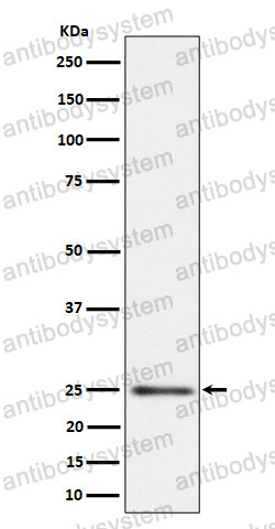 Anti-MRPS15 Antibody (R2B44)