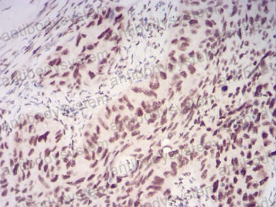 Anti-CBX1 Antibody (R3P92)