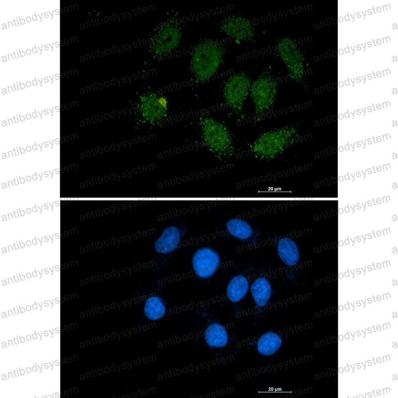 Anti-SMAD3 Antibody (R2B46)