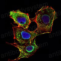 Anti-SMAD3 Antibody (R3P94)