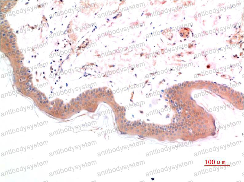 Anti-Phospho-Smad3 (Ser425) Antibody (R3P95)