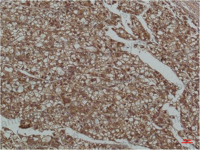 Anti-SMAD3 Antibody (R3P96)