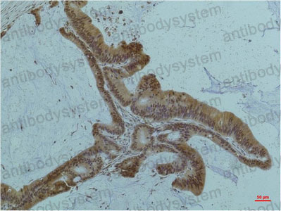 Anti-SMAD2/3 Antibody (R3P97)