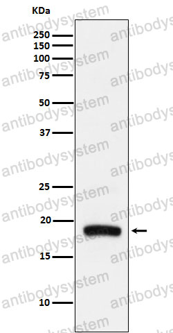 Anti-ARF5 Antibody (R2B49)