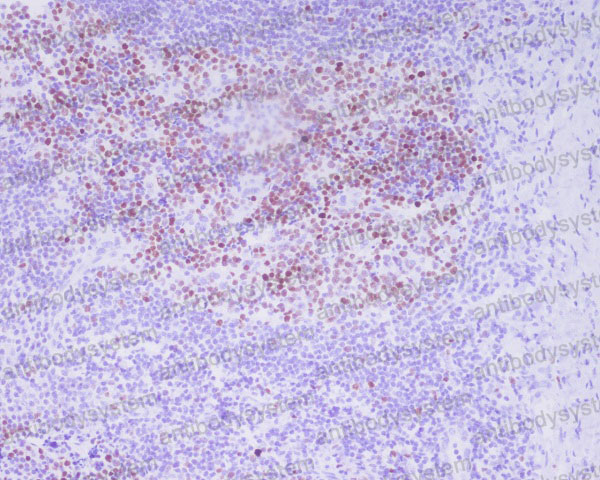 Anti-Phospho-Histone H3 (T3) Antibody (R1A50)