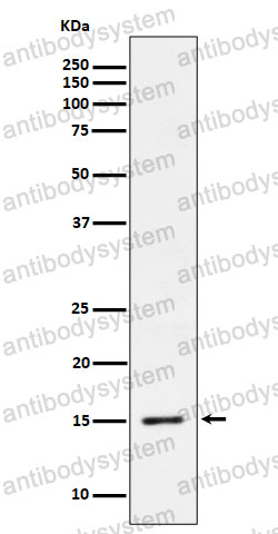 Anti-Phospho-Histone H3.3 (S31) Antibody (R1A53)