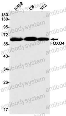 Anti-FOXO4 Antibody (R2B58)
