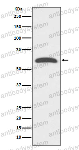 Anti-FOXO4 Antibody (R2B56)
