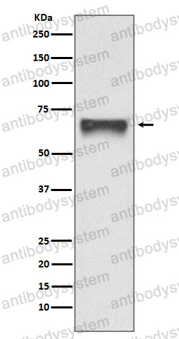 Anti-FOXO4 Antibody (R2B57)
