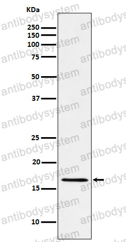 Anti-RBM3 Antibody (R2B59)