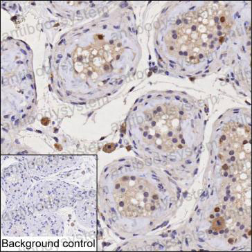 Anti-RBM3 Antibody (R3Q07)