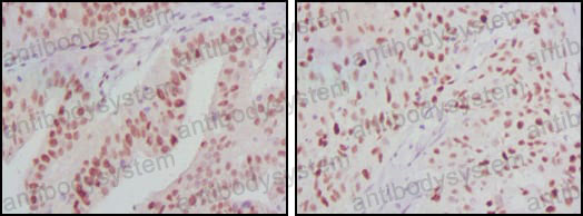 Anti-ATP2C1 Antibody (R3Q08)