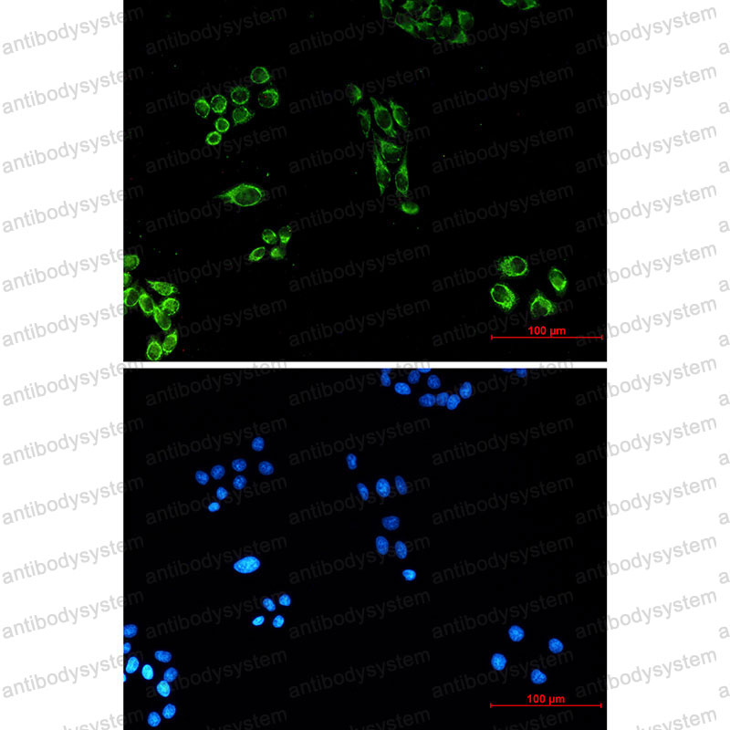 Anti-CYCS Antibody (R3Q11)
