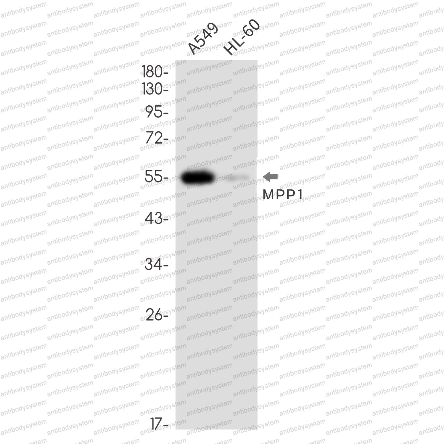 Anti-MPP1 Antibody (R2B64)