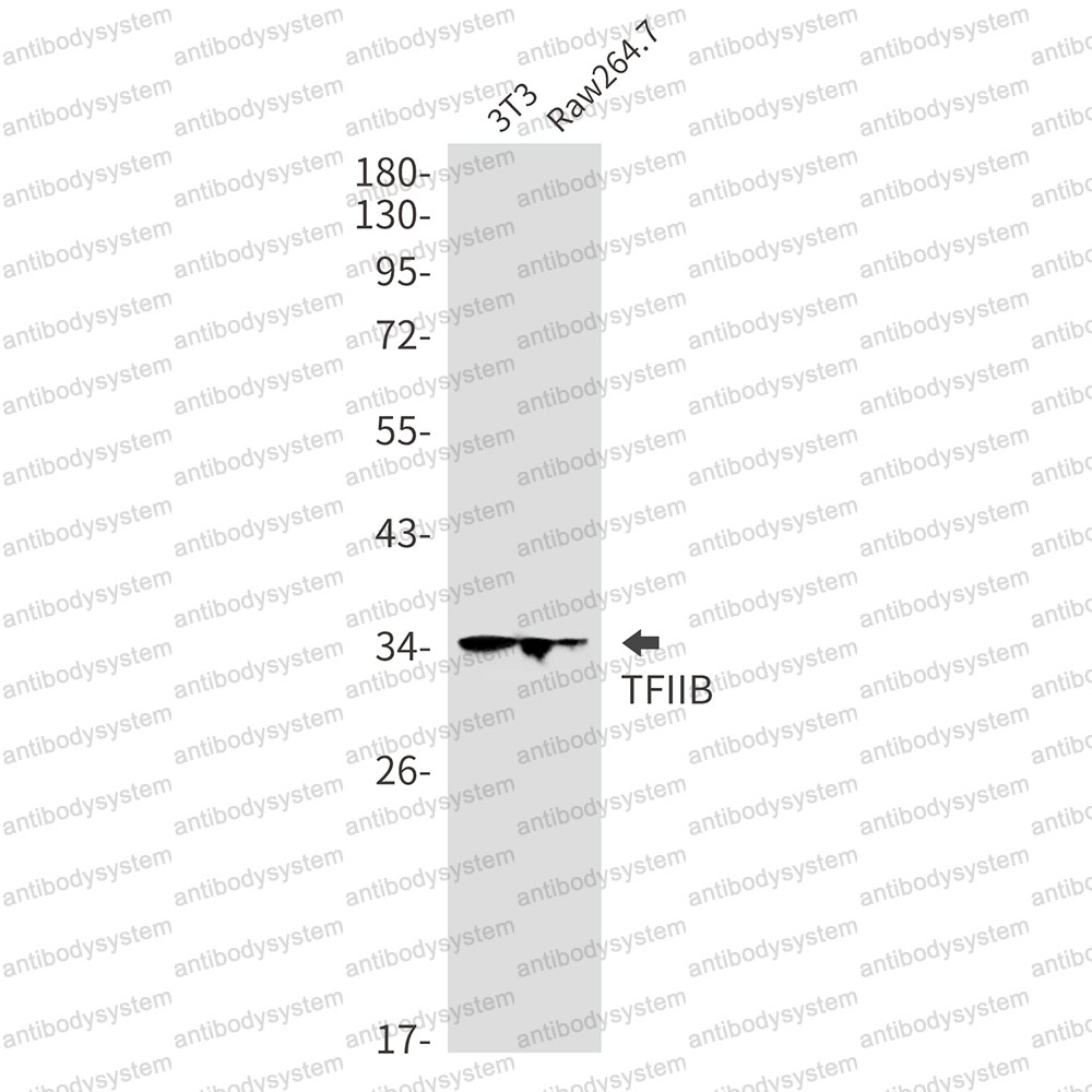 Anti-GTF2B Antibody (R2B71)