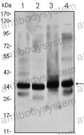 Anti-GTF2B Antibody (R3Q13)
