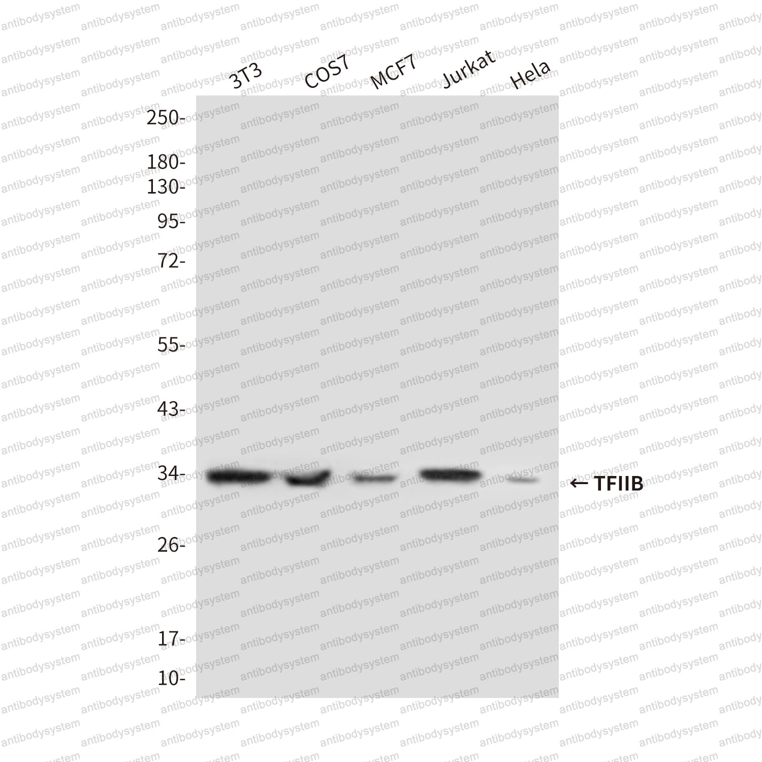 Anti-GTF2B Antibody (R3Q14)