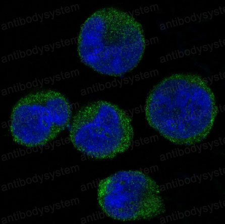 Anti-CDK6 Antibody (R2B72)