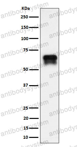 Anti-CDK16 Antibody (R2B74)